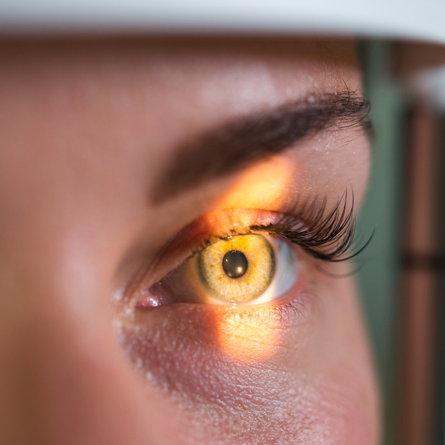Vision Therapy in Providence